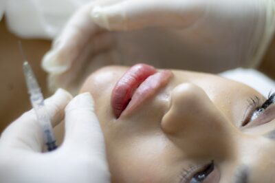 Lip Fillers vs. Other Lip-Enhancement Options